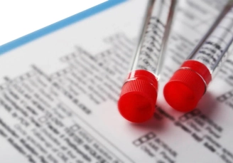 лабораторные анализы у терапевта на столе